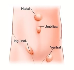 Fotohernia1 2 Fotohernia1 Uai