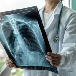 Blogtema3 Pulmoncover 161121 Uai